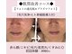 エステティックサロン さらの写真