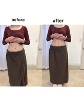 ジョワイユ(Joyeux)/腸の位置でお腹は変わる