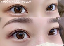 アイデュース acty店(eyeduce)
