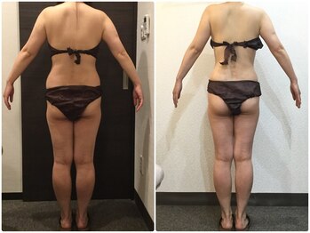 美容整体ウェリナ あま甚目寺院/小顔矯正/骨盤矯正/美脚サロン