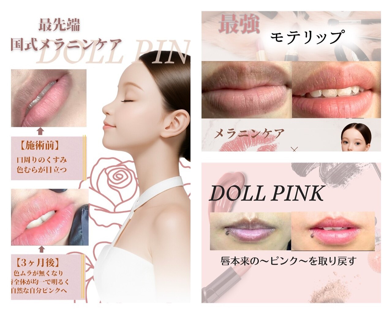 シエル(CIEL)｜ホットペッパービューティー