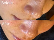 アリス(Alice)/マツヤニWAX Before/After 