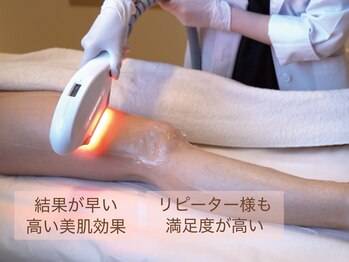 エシャーム(echarme)の写真/【圧倒的な脱毛効果！肌質も滑らかに変わります】肌魅せの季節に向けて透明感溢れる肌へ導きます◎
