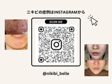 ベル(Belle)の雰囲気（肌質改善ワックスBestサロン賞【2年連続全国2位受賞サロン★】）