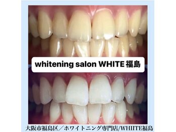 ホワイトニングサロン ホワイト(WHITE)/セルフホワイトニング/大阪/福島