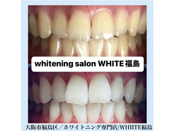 ホワイトニングサロン ホワイト(WHITE)/セルフホワイトニング/大阪/福島