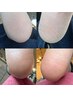 【フットケア】夏に向けてガサガサ角質ケア&フットネイルケア