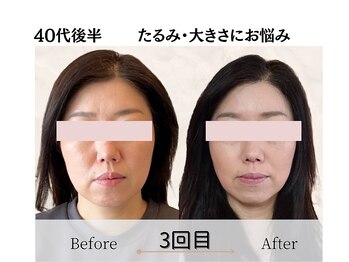 エミフル(emifull)/こんなに変わるの?