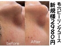 アヴァンサル(Avanzar)