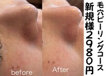 アヴァンサル(Avanzar)