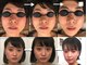 サロンチオリ 烏丸(Salon Chiori)の写真/施術歴累計1万人突破!希少な米国式小顔矯正で“老け見え”顔に速攻アプローチ！たるみ改善で小顔印象UP☆