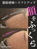 【立体小顔】脂肪増殖×リフトアップフェイシャル　120分