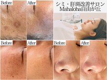 マハロハ 自由が丘(Mahaloha)