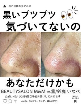 エムアンドエム(M&M)/