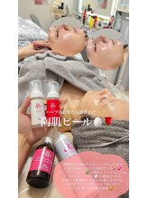 クレヴィー(Creviy)/陶肌ピール1回