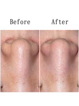 グラシア(gracia)/シミ・毛穴ケア専門店gracia