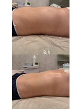 ブリア 横浜(BRILLA)/腸もみ×美乳ケア