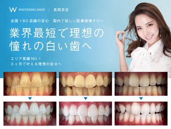 ホワイトニングショップ 長岡京店