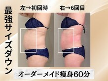 イヨヨ(iyoyo)/BeforeAfter　施術６回
