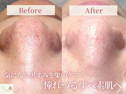 クリアホワイト(Clear White)の写真