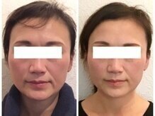 美容整体ウェリナ あま甚目寺院/小顔矯正/骨盤矯正/美脚サロン