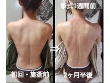 オアシス(OASIS)/ホット★カッサ