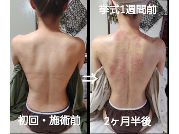 オアシス(OASIS)/ホット★カッサ