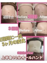 ムーンブロッサム(MoonBlossom)/上半身痩身オールハンド90分　