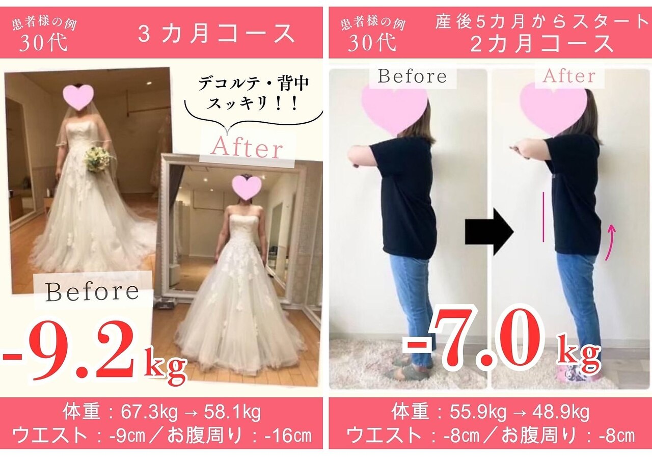 【大幅値下げ】リファインシュール 痩身エステ 心斎橋店の痩身エステビフォーアフター体験談一覧｜オリエンタル