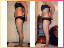 ベリンダ 銀座店(BELINDA)/☆ビフォーアフターのご紹介☆