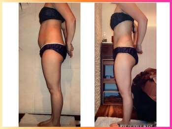 ベリンダ 銀座店(BELINDA)/☆ビフォーアフターのご紹介☆