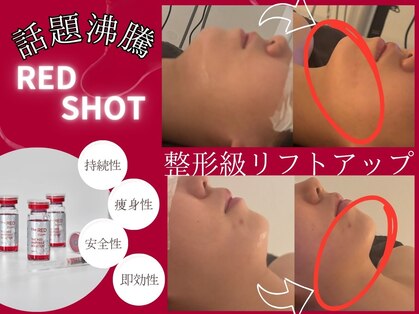 パタティパタタ(PatatiPatata)の写真