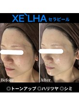 シュ シュ(chou chou)/【セラピール】