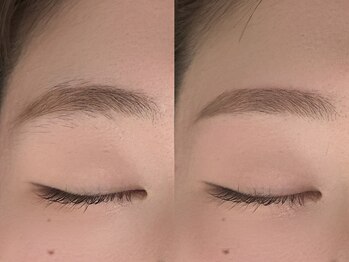 イロドリ(IRODORI)/お顔にフィットする平行アーチ