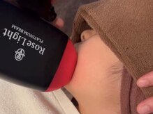 ルナステラ 七尾店/LEDローズ脱毛