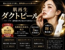 アンベリール(embellir)