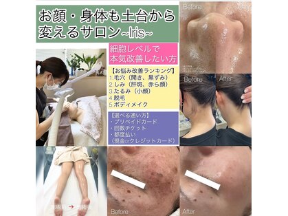 イリス(Iris)の写真