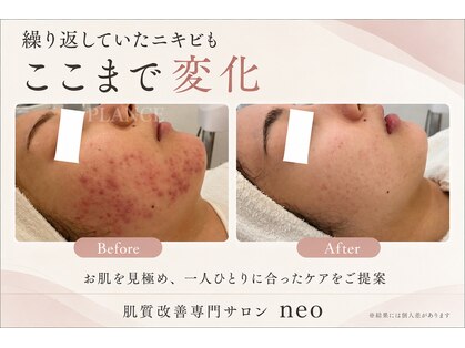 ネオ 熊本玉名(neo)の写真