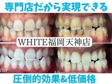 ホワイト 福岡天神店(WHITE)