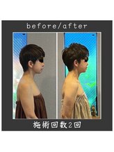 サロン ド ハーモニー美/コルギ♪たるみ、えらの改善等