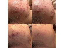 エピロマ(EPILOMA)の雰囲気（エイジングケアや毛穴ケア、お肌悩みはお気軽にご相談ください）