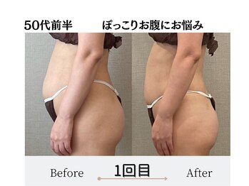 エミフル(emifull)/美容外科も考えました、、、