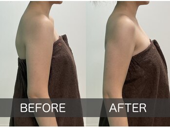 スキャプレーン 米子(SCAPLANE)/BEFORE AFTER事例