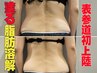8月限定!痛み0!表参道初☆レモンボトルより効果的!?脂肪即分解燃焼☆初回体験