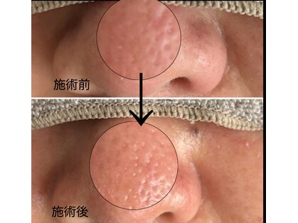 フルール(fleur)の写真