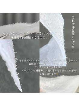 マリーブ 恵比寿本店(MAREVE)/究極のお顔のクレンジング