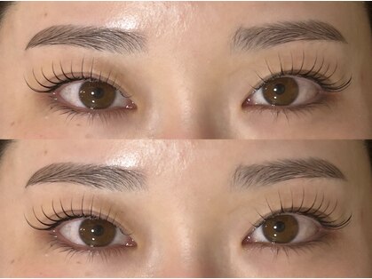 ゾーイ(Zoe)の写真