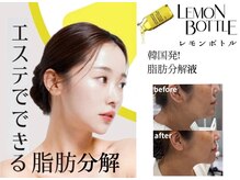 イーズスリミングプロ 横浜コレットマーレ店の雰囲気(【レモンリフト】レモンボトル脂肪分解×フェイスビートダンス)