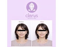 クラルスシンメトリーサロン 高槻店(Clarus Symmetry Salon)