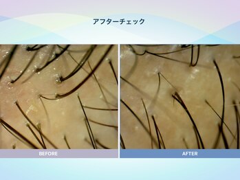 アンス(anth:)/お客様の仕上がり